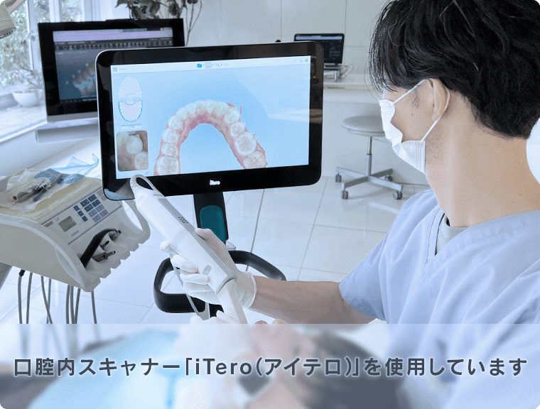 口腔内スキャナー（iTero）による歯科矯正